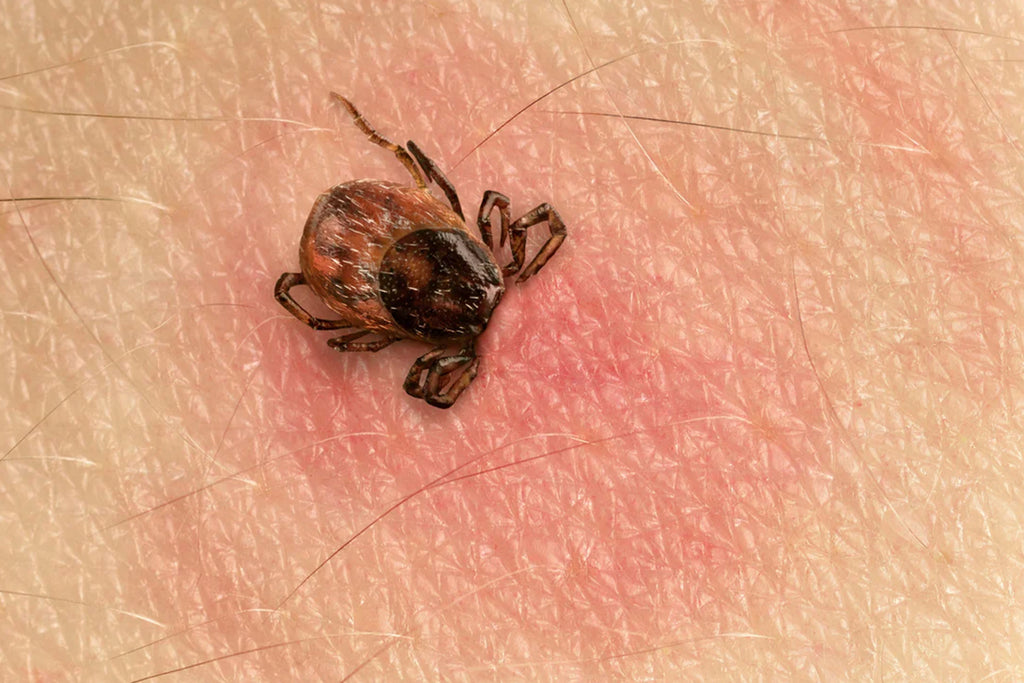 Lyme Disease (not Lymes) and Tick Bites Rio Health